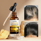 SADOER Hair Growth Serum Ginger Essence Hair Care Oil 30ml SD89101