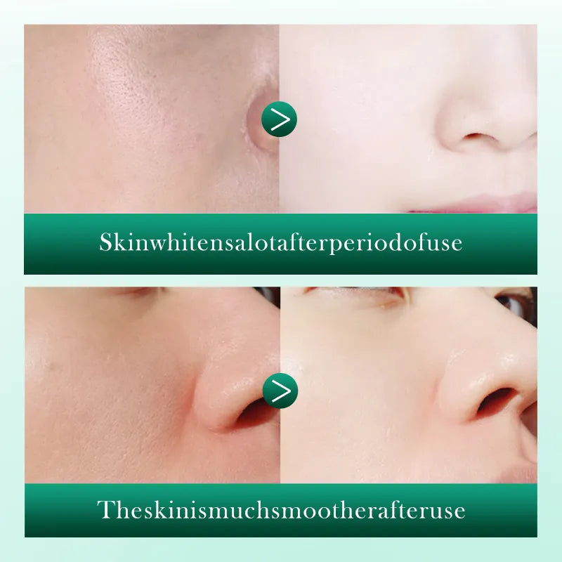 SADOER Retinol Centella Anti Wrinkle Soothing Facial Moisturizing Facial Serum Essence For Girls & Women 40ml SD84427