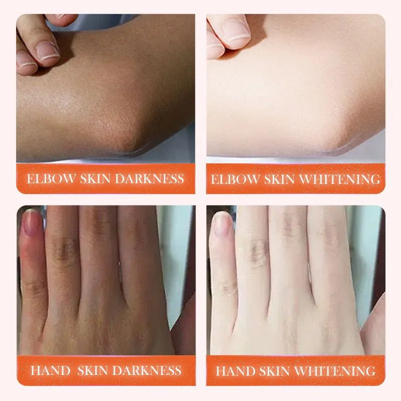 Sadoer Joint Melanin Removal Serum Dark Skin Lightening & Whitening Essence Body Care Oil 50ml SD58017